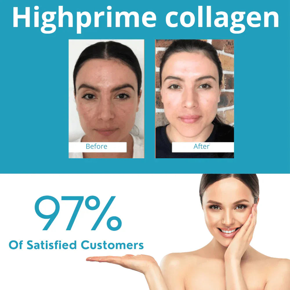 Set de   Mascarillas de colágeno soluble Skin Care Koreano